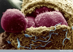 Human Embryo exposing the embryonic cells. Credit: Yorgos Nikas. Wellcome Images.