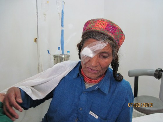 A post op patient. Photo: Badrudin Kurwa. Copyright.